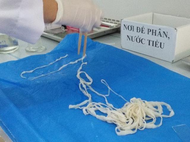 Sức khỏe đời sống - Ớn lạnh những ca nhiễm ký sinh trùng "có một không hai”