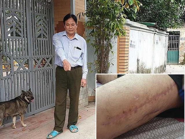 Pháp luật - Làm rõ vụ cảnh sát 113 bắn người vì nghi là ngáo đá