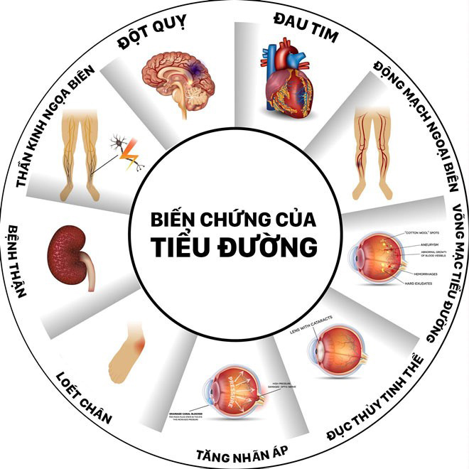 Glugaz – Viên uống giúp hỗ trợ hạ đường huyết cho người tiểu đường - 1