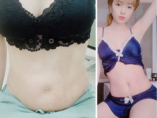 Làm đẹp - Bụng con kiến thành "rạn nát bét", vợ Lê Hoàng The Men làm gì để lấy lại vòng 2?