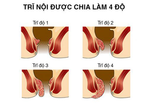 Ngứa nóng rát hậu môn: Nguyên nhân và giải pháp điều trị hiệu quả