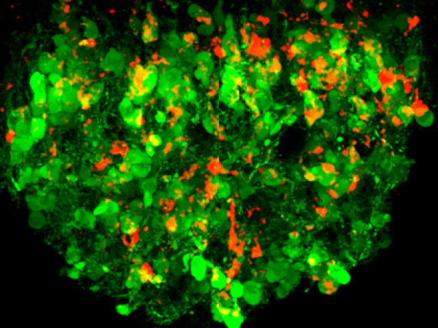 Sức khỏe đời sống - Ngỡ ngàng 6 bộ phận lạ vừa lộ diện trong... cơ thể người