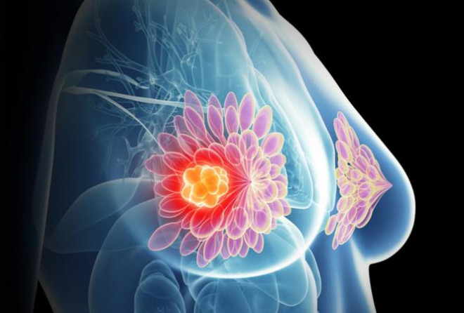 Công cụ trí tuệ nhân tạo mới của Google có thể chẩn đoán ung thư vú tốt hơn cả hình ảnh X.quang.