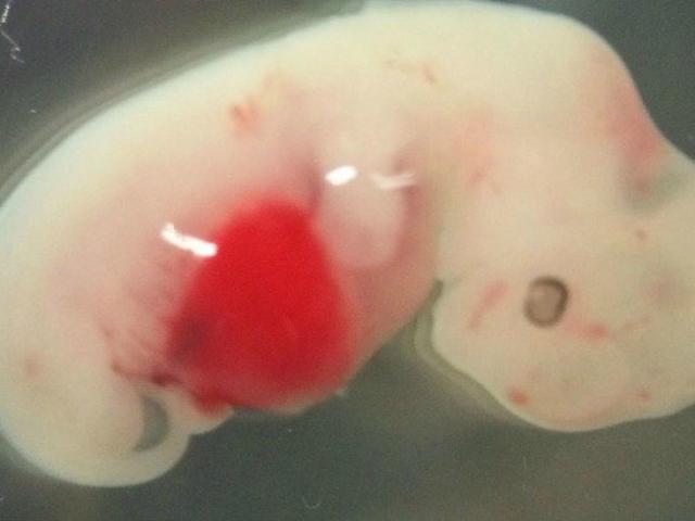 Thế giới - NÓNG nhất tuần: Cái kết của người tạo ra em bé chỉnh sửa gen đầu tiên thế giới