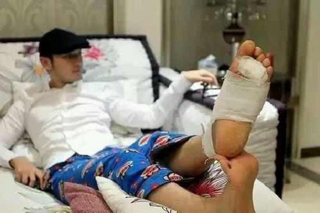 Năm 2014, Huỳnh Hiểu Minh tham gia phim điện ảnh “Bạch phát ma nữ”, đóng cặp với Phạm Băng Băng. Trong thời gian quay phim, nam diễn viên đã gặp tai nạn nghiêm trọng khi bị ngã từ độ cao 3 m. Sau đó, anh bị gãy ngón chân vì tiếp đất bằng chân trái, tay trái và đầu gối phải bị dập.