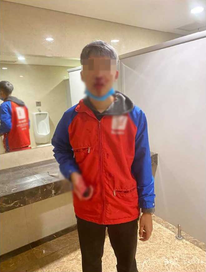 Anh P. bị đánh chảy máu ở vùng mặt