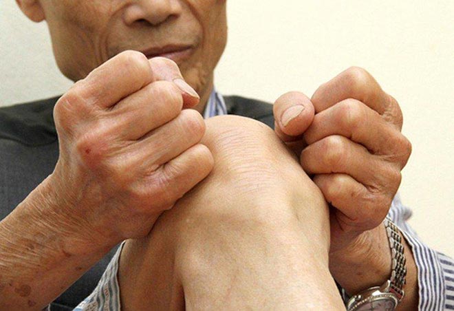 Thoái hóa khớp gối là bệnh thường gặp ở người cao tuổi