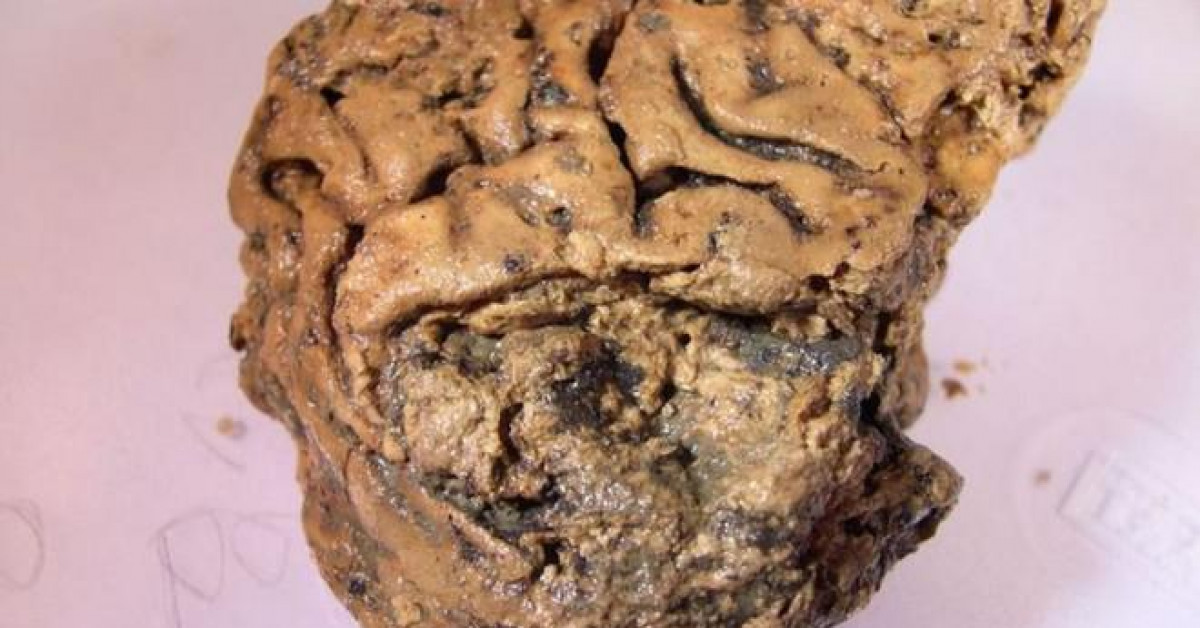 Du lịch - Bí ẩn bộ não người 2.600 năm tuổi vẫn nguyên vẹn không phân hủy