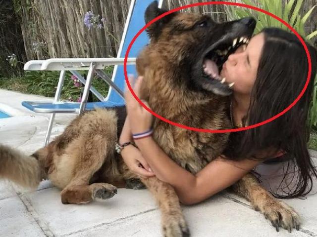 Thế giới - Làm cử chỉ nhiều người hay làm với chó cưng, thiếu nữ bị đớp trúng mặt