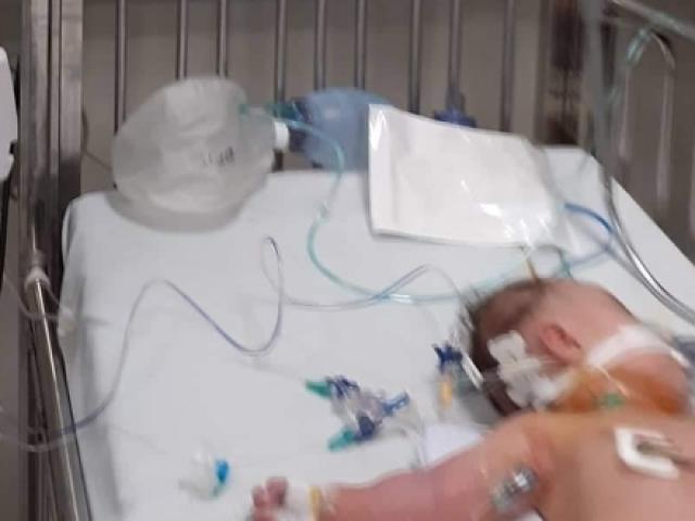 Sức khỏe đời sống - Pha sữa non trộn với sữa mẹ cho trẻ uống, bé 3 tháng tuổi nguy kịch