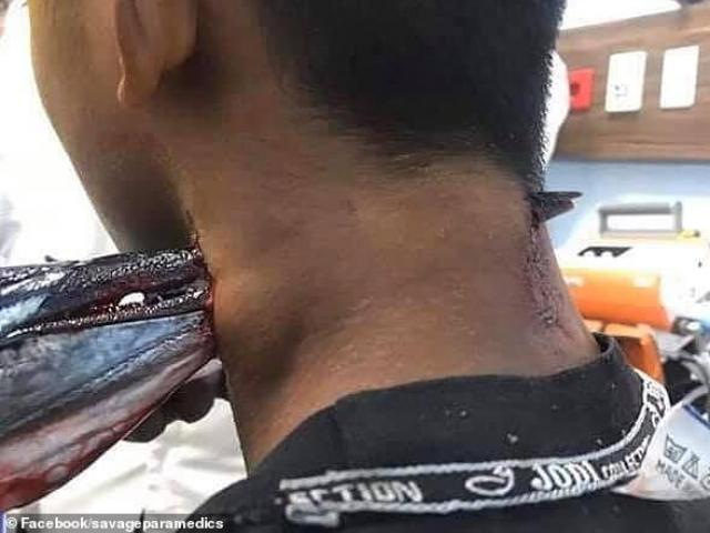 Thế giới - Indonesia: Đang câu cá, bị cá nhái phi thân khỏi mặt nước đâm xuyên cổ