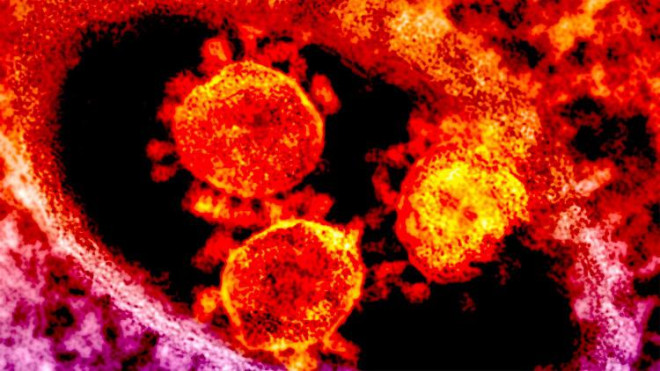 Các tế bào virus. -Ảnh: Global Look Press