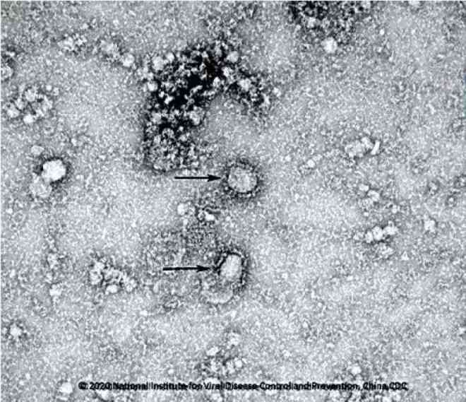 Trung Quốc công bố những hình ảnh đầu tiên của virus Vũ Hán - 1