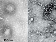 Thế giới - Trung Quốc công bố những hình ảnh đầu tiên của virus Vũ Hán
