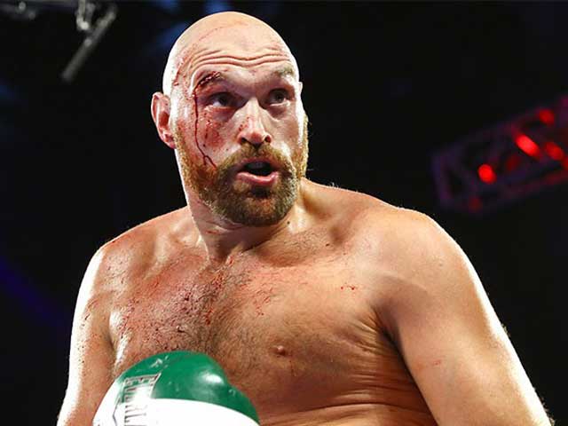 Tyson Fury có sức mạnh vô song ở những cú ra đòn