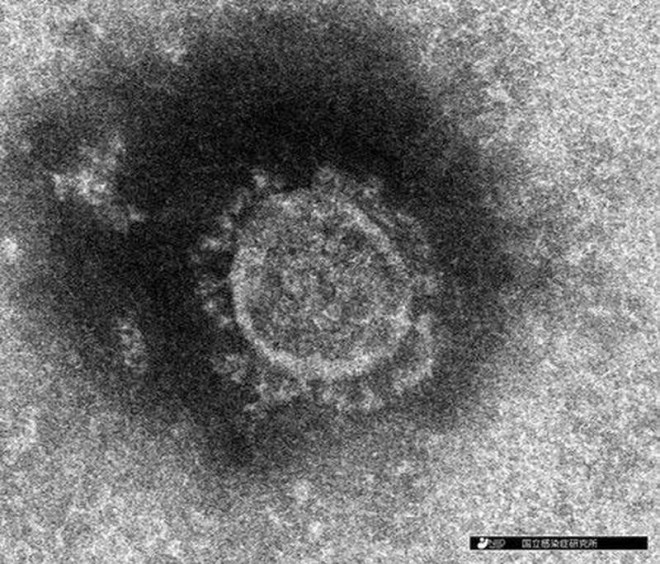 Virus Corona được cô lập thành công ở Nhật Bản. Ảnh: NIPPON