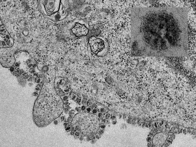 Hình ảnh hiển vi đầu tiên về quá trình phân bào của virus Corona mới. Ảnh: SCMP