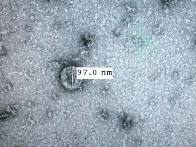 Tin tức trong ngày - Nuôi cấy thành công virus Corona: Việt Nam có thể phát triển vắc-xin