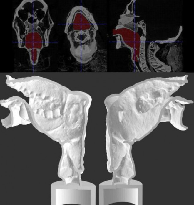 Đường dẫn giọng nói nhân tạo của Nesyamun được tạo ra bằng công nghệ in 3D. Ảnh: BBC