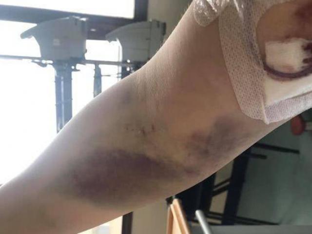 Sức khỏe đời sống - Bà mẹ trẻ tử vong sau khi nhập viện với những vết bầm tím bí ẩn