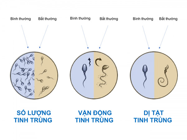 Viên uống tăng chất lượng tinh trùng được các cặp vợ chồng mong con tìm kiếm! - 4