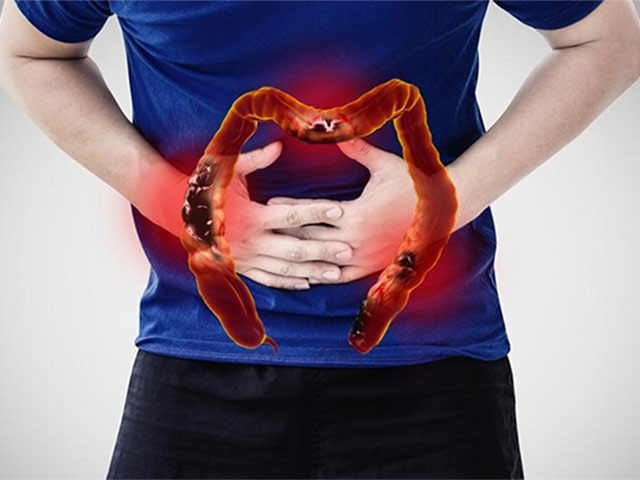 Tìm thấy lại sự sống nhờ thoát “nỗi khổ” viêm đại tràng - 1