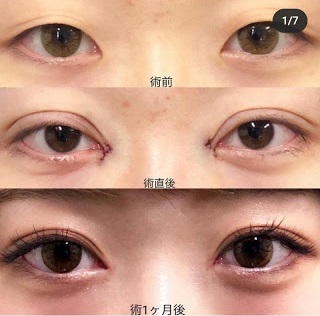 Kỹ thuật phẫu thuật mắt hai mí ở Nhật Bản trở thành chủ đề bàn tán trên mạng xã hội Hàn Quốc.