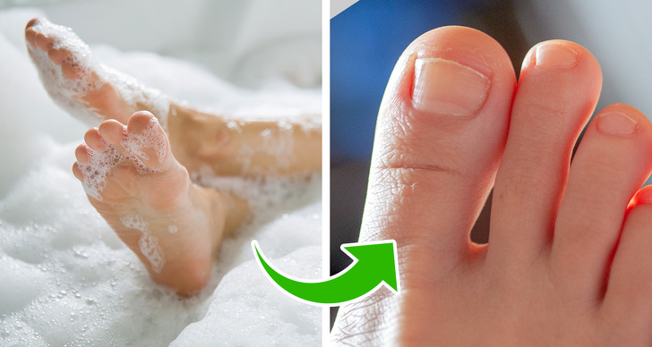 Lười 1 phút rửa chân khi tắm có thể khiến bạn ân hận khi mắc phải các căn bệnh sau - 6