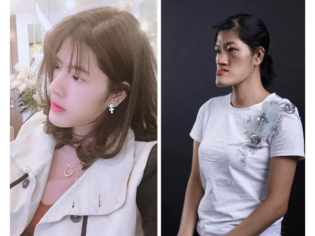 Làm đẹp - 9X Ba Vì, Nam Định thoát "gương mặt quỷ", xinh xắn tự tin để làm giáo viên, DJ