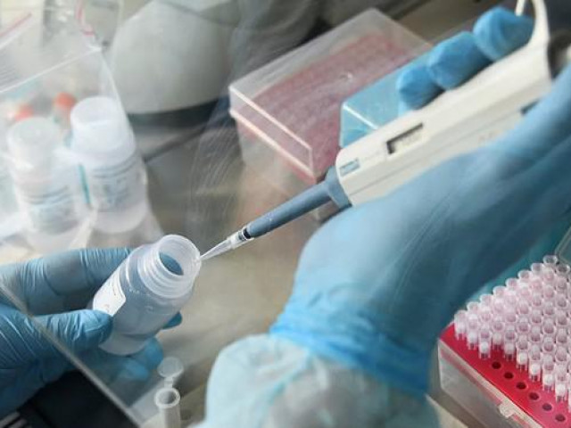 Thế giới - Hơn 30 ca nhiễm Covid-19, Mỹ cảnh báo khả năng lây lan cao