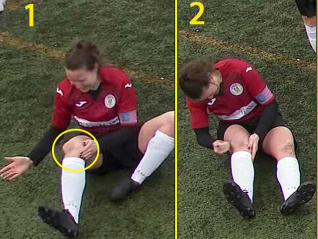 Hình ảnh tự chữa chấn thương đáng sợ của Jane O'Toole