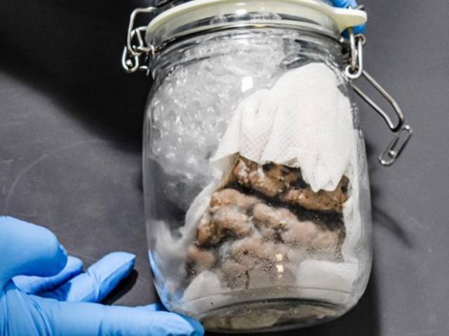 Phi thường - kỳ quặc - Phát hiện não người trong kiện hàng vận chuyển qua biên giới Mỹ