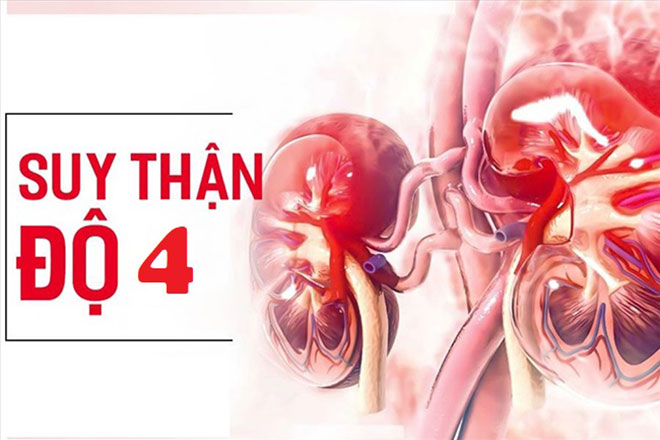 Suy thận độ 4 thuộc vào giai đoạn gần cuối của bệnh suy thận mạn tính