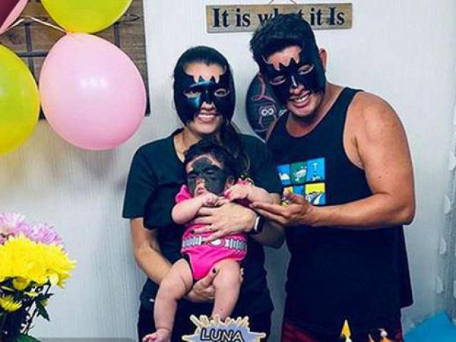 Bạn trẻ - Cuộc sống - Con gái chào đời với vết bớt đen khổng lồ trên mặt, bố mẹ làm một hành động khiến ai cũng "cứng họng"