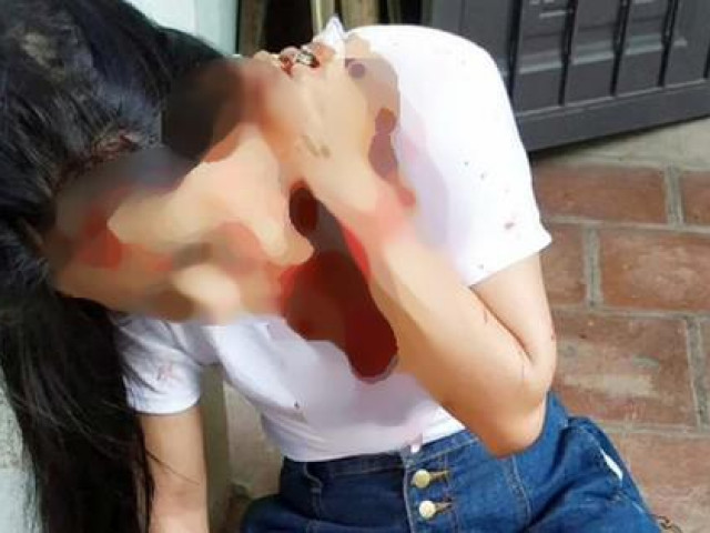 Pháp luật - Chồng hờ 74 tuổi bất ngờ lao tới đâm trọng thương con gái riêng của vợ