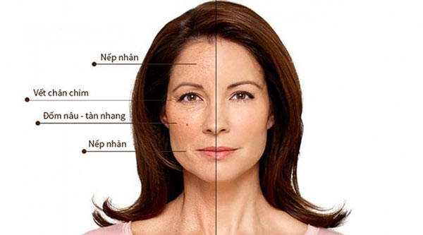 Suy giảm nội tiết tố Estrogen ảnh hưởng nghiêm trọng đến sức khỏe của phái nữ.