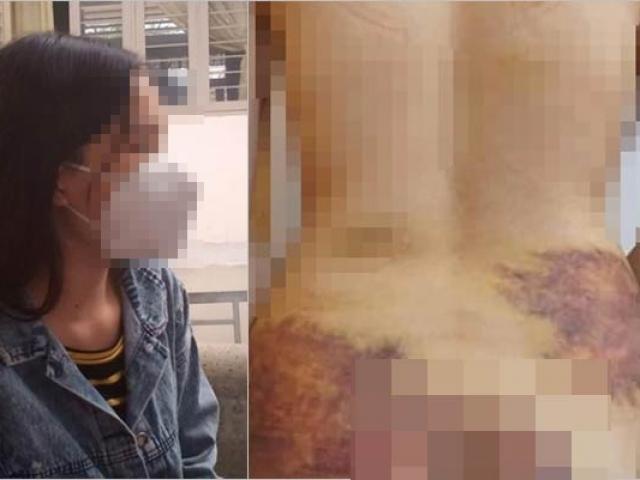 Pháp luật - Vụ chồng bạo hành, ép vợ quan hệ tình dục: Xem xét khởi tố hình sự