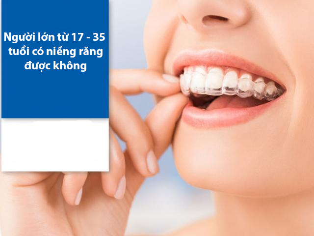 Niềng răng là gì? Niềng răng có đau không và những lưu ý bạn nên biết - 4