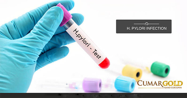 Vi khuẩn HP: Nguyên nhân, triệu chứng và cách xử lý - 2