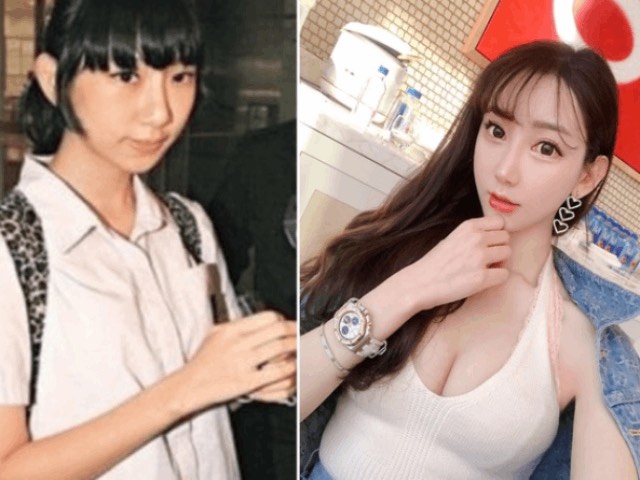 Làm đẹp - Tạ Chỉ Huệ phẫu thuật thẩm mỹ, "lột xác" bất ngờ