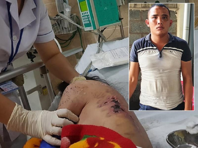 Pháp luật - Lời khai kẻ đánh nữ nhân viên từ chối kích dục