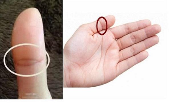 Bàn tay có đường vân mắt phượng ở ngón cái - (Ảnh minh họa)
