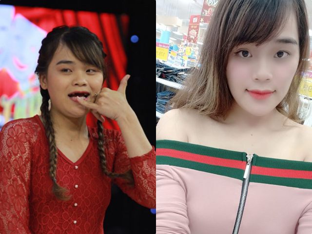 Giải trí - "Thánh sún" được Ngô Kiến Huy tài trợ tiền làm răng lột xác thành hot girl khó nhận ra