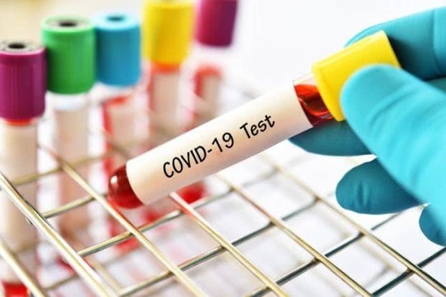 Covid -19: Những triệu chứng nhiễm ít ai ngờ tới ở một phụ nữ - 3