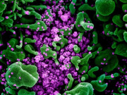 Thế giới - Hình ảnh rõ ràng nhất về virus Corona tấn công làm chết tế bào người