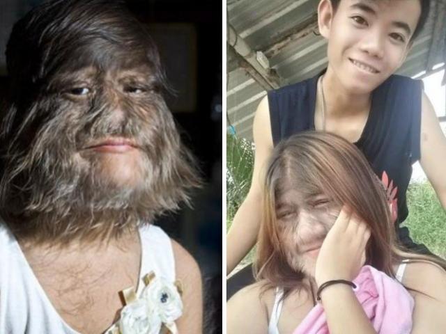 Bạn trẻ - Cuộc sống - Cô gái "người sói" đã hủy hôn với chồng sắp cưới, khoe bạn trai mới đầy ngọt ngào