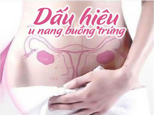 Dấu hiệu u nang buồng trứng bạn nên cập nhật