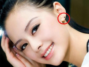 Bạn trẻ - Cuộc sống - 6 nốt ruồi “đại cát” báo hiệu cuộc đời giàu sang,  luôn có người ở bên giúp đỡ