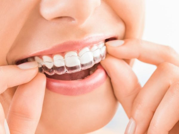 Tẩy trắng răng có đau và gây hại ảnh hưởng  tới sức khỏe không? - 2