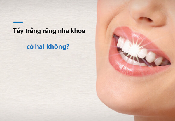 Tẩy trắng răng có đau và gây hại ảnh hưởng  tới sức khỏe không? - 5